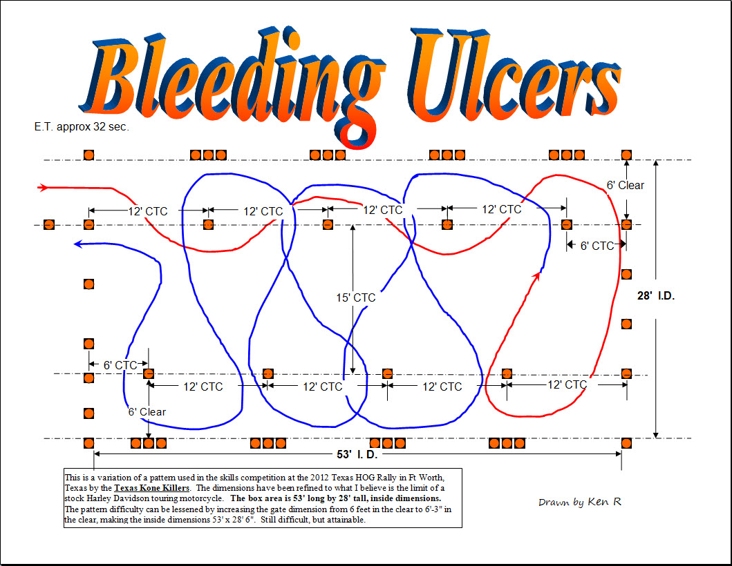Bleeding Ulcers